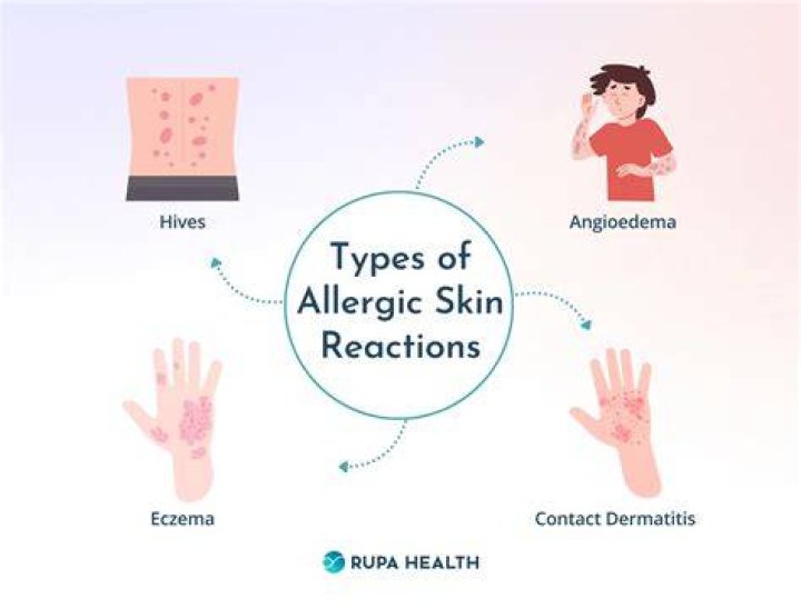 Are some people allergic to argan oil?