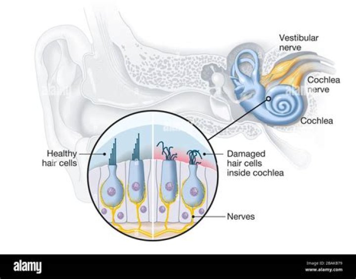 Can damaged hair cells be repaired?