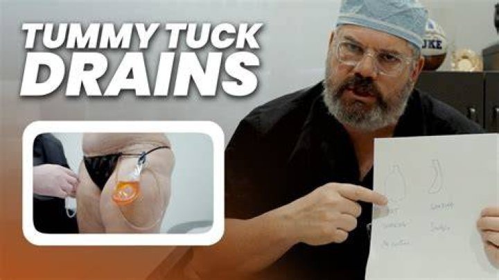 Do you have drains after a tummy tuck?