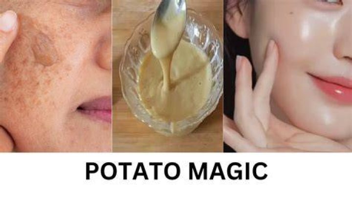 Does potato help in skin lightening?