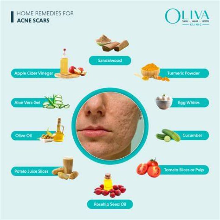 Does Retinol heal acne scars?
