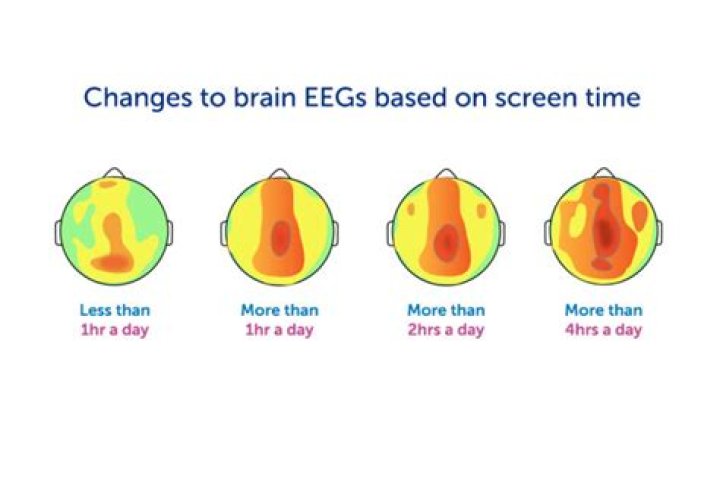 Does TV affect babies brain development?