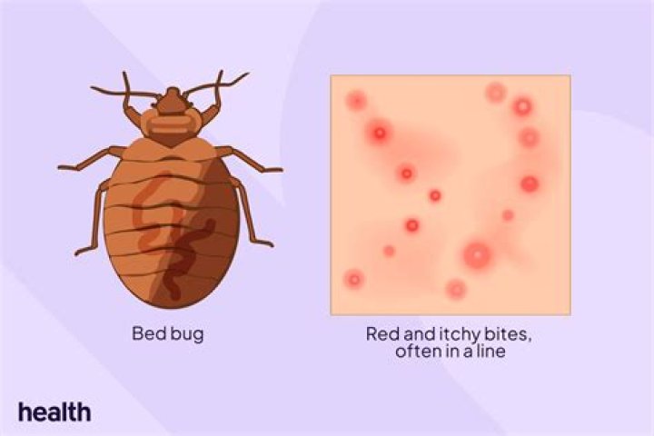 How can you tell bed bug bites from other bites?