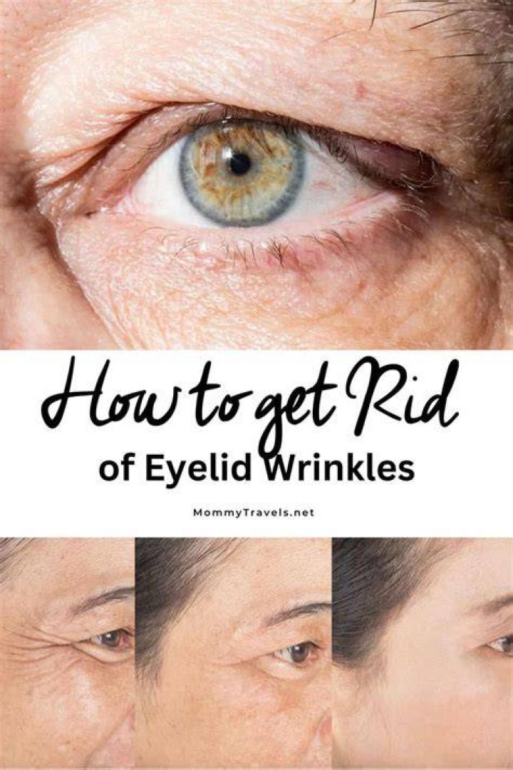 How do you get rid of upper eyelid wrinkles?