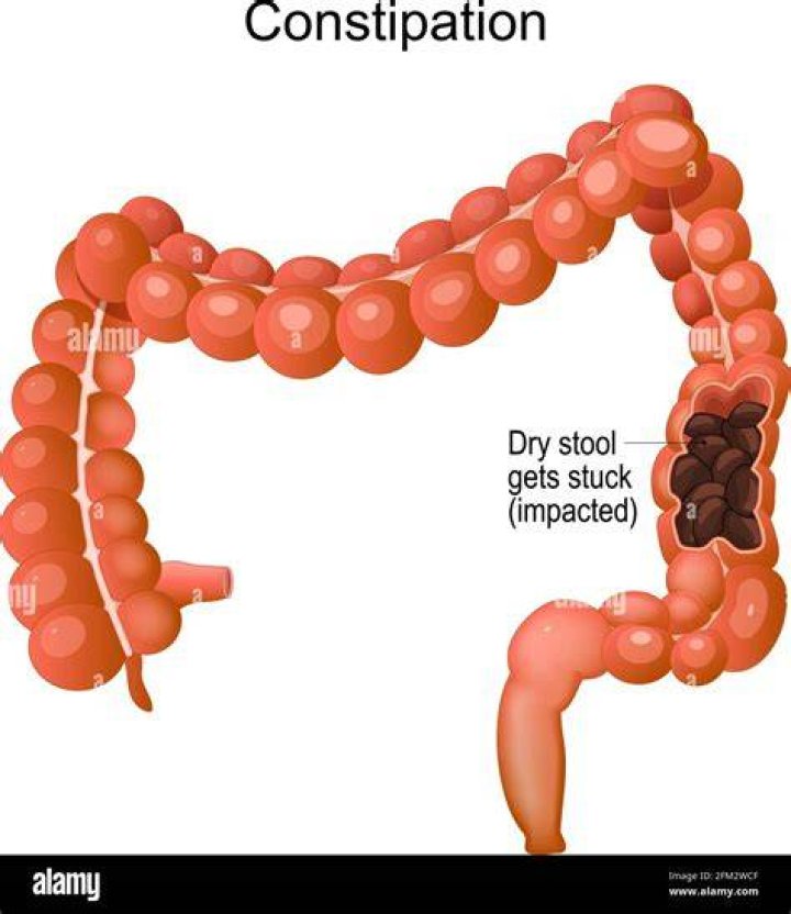 How do you know if your impacted with poop?