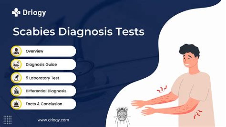 How do you test for scabies?