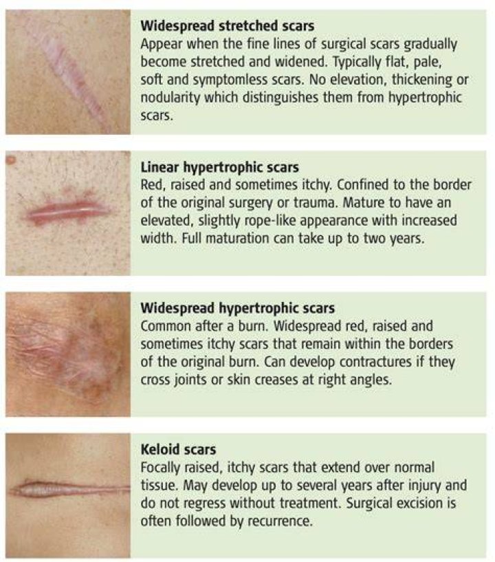 How long should a scar hurt after surgery?