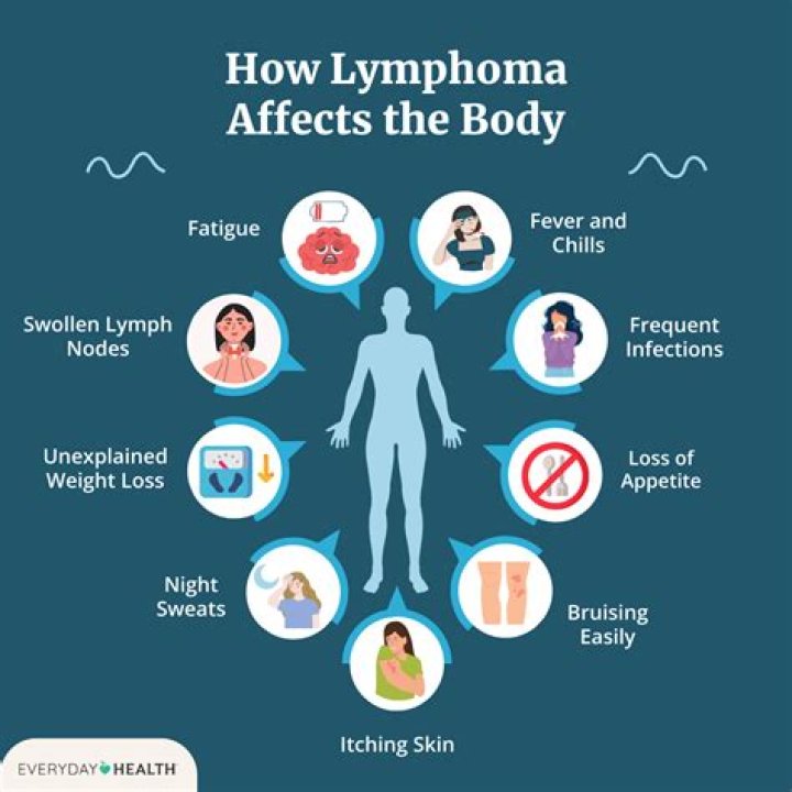 Is stomach common site for lymphoma?