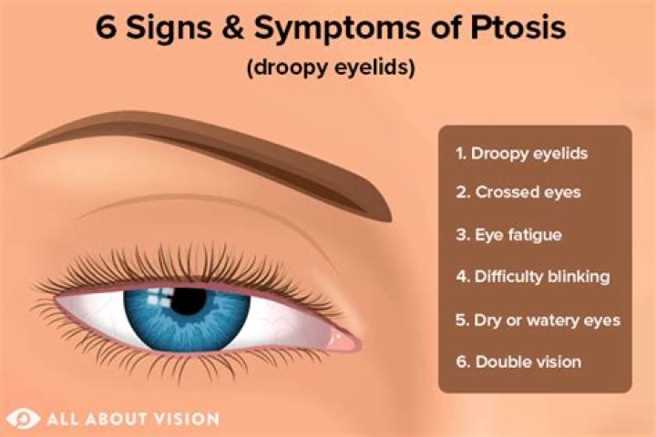 What causes baggy eyelids?