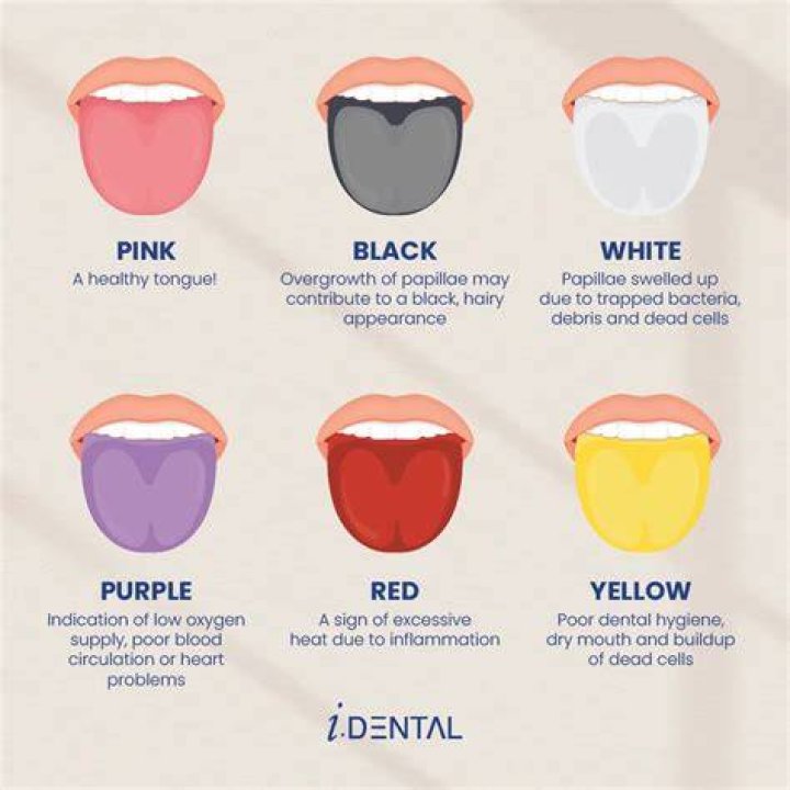 What does a healthy tongue look like underneath?
