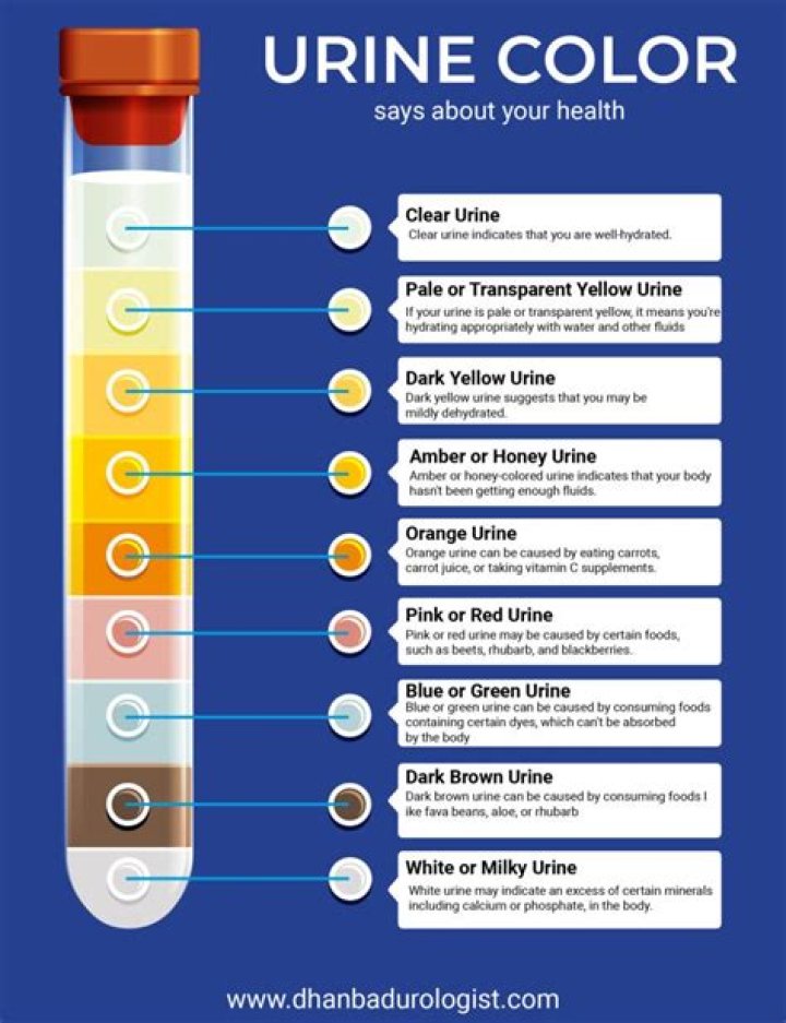 What foods cause brown urine?
