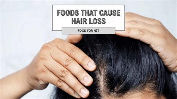 What foods cause oily hair?
