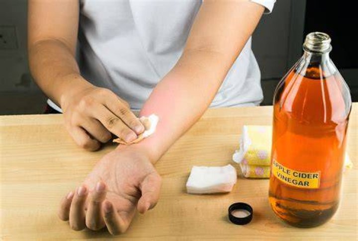 What happens if you leave apple cider vinegar on your skin?