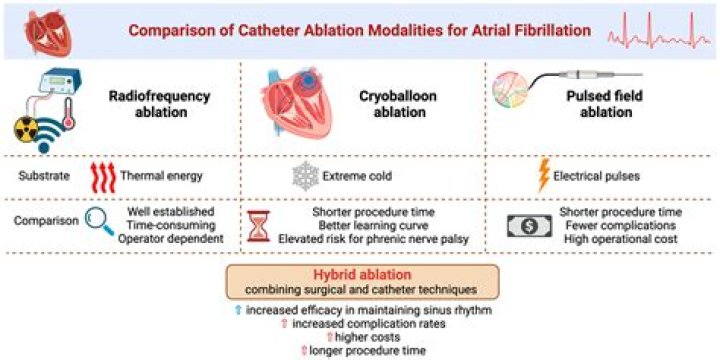 What is the alternative to cardiac ablation?