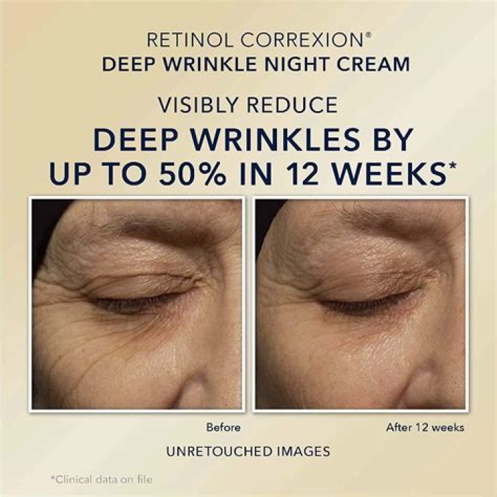 What percentage of retinol is in RoC Deep Wrinkle serum?