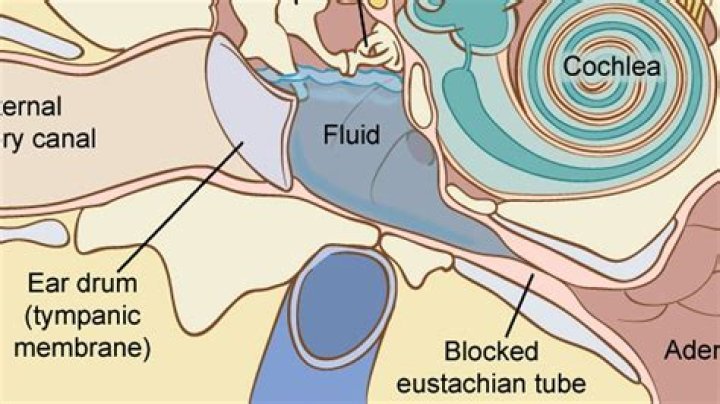 Why can I hear fluid in my neck?